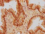 PP5 Antibody in Immunohistochemistry (Paraffin) (IHC (P))