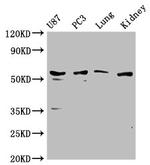 PP5 Antibody in Western Blot (WB)