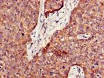 PPT1 Polyclonal Antibody
