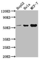 PRAMEF18 Antibody in Western Blot (WB)