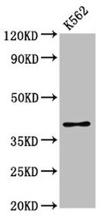 PRB1 Polyclonal Antibody
