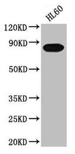 PREP Antibody in Western Blot (WB)