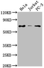 PRICKLE3 Antibody in Western Blot (WB)