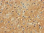 PRKAR2A Antibody in Immunohistochemistry (Paraffin) (IHC (P))