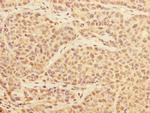 PRPF4 Antibody in Immunohistochemistry (Paraffin) (IHC (P))