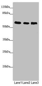 PRPF4 Antibody in Western Blot (WB)