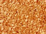 PSD Antibody in Immunohistochemistry (Paraffin) (IHC (P))