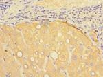 Presenilin 1 Polyclonal Antibody