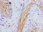 Presenilin 1 Polyclonal Antibody
