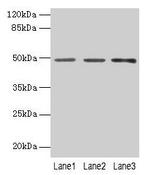 PSG6 Polyclonal Antibody