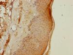 PSMB3 Antibody in Immunohistochemistry (Paraffin) (IHC (P))