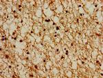 PSMG1 Antibody in Immunohistochemistry (Paraffin) (IHC (P))
