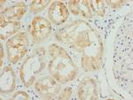PSPH Antibody in Immunohistochemistry (Paraffin) (IHC (P))