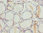 PSPH Polyclonal Antibody