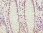 PTGES2 Antibody in Immunohistochemistry (Paraffin) (IHC (P))