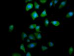 PTGR2 Polyclonal Antibody