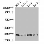 RAB25 Antibody in Western Blot (WB)