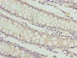 RAB3B Polyclonal Antibody