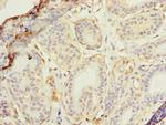 RAD23B Polyclonal Antibody