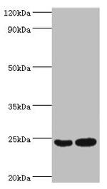 RAN Antibody in Western Blot (WB)