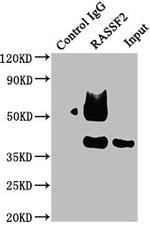 RASSF2 Antibody in Western Blot (WB)