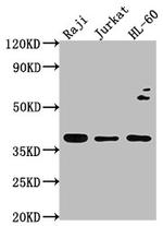 RASSF2 Polyclonal Antibody