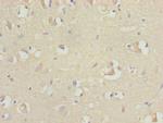 RFPL2 Antibody in Immunohistochemistry (Paraffin) (IHC (P))