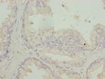 RFPL2 Polyclonal Antibody