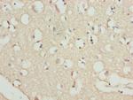 RFPL2 Antibody in Immunohistochemistry (Paraffin) (IHC (P))