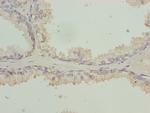 RFPL2 Polyclonal Antibody