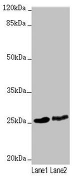 ZNF313 Antibody in Western Blot (WB)