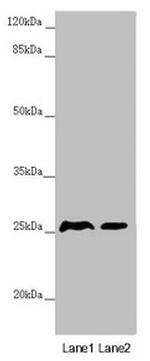 ZNF313 Antibody in Western Blot (WB)