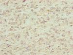 RNF13 Antibody in Immunohistochemistry (Paraffin) (IHC (P))