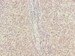 RNF13 Polyclonal Antibody