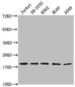 RPL24 Polyclonal Antibody