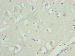 RPL9 Antibody in Immunohistochemistry (Paraffin) (IHC (P))