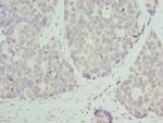 RPL9 Polyclonal Antibody
