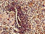 RPS15 Antibody in Immunohistochemistry (Paraffin) (IHC (P))