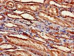 RPS2 Antibody in Immunohistochemistry (Paraffin) (IHC (P))