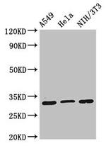 RPS2 Antibody in Western Blot (WB)