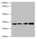 RSU1 Polyclonal Antibody