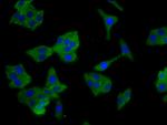 SCNN1B Polyclonal Antibody