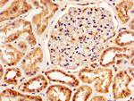 SERPINA6 Antibody in Immunohistochemistry (Paraffin) (IHC (P))
