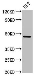 SERPINA6 Antibody in Western Blot (WB)