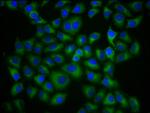 HLA-G Polyclonal Antibody