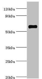 SRSF4 Antibody in Western Blot (WB)