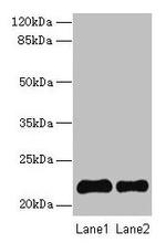 SIRP delta Polyclonal Antibody