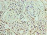 CRACC Polyclonal Antibody