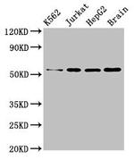 SLC16A8 Antibody in Western Blot (WB)