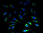 SLC1A6 Polyclonal Antibody